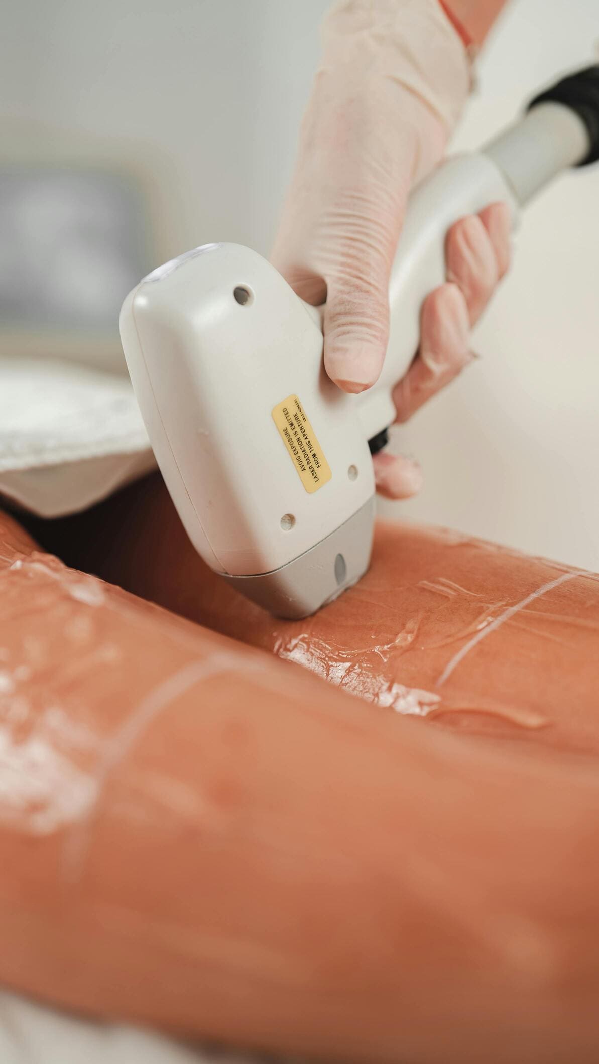 Depilación corporal